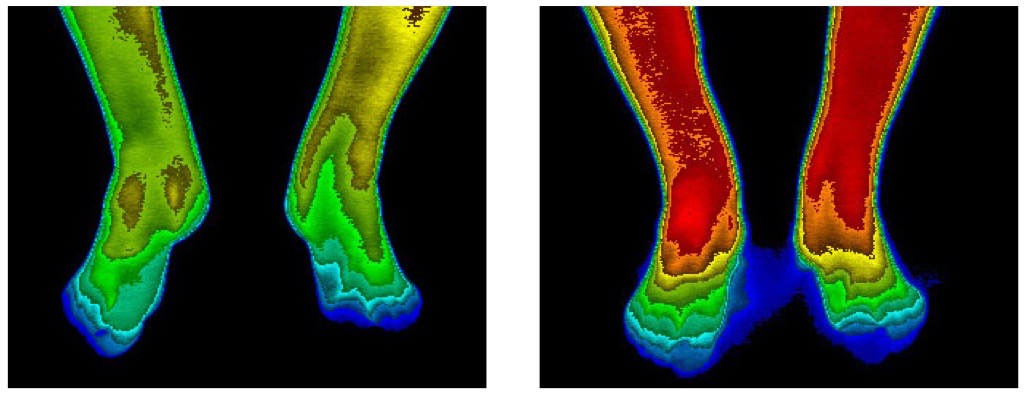 Thermal images of feet with diabetic neuropathy before and after Firefly therapy